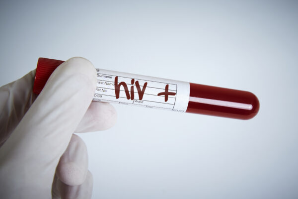 Laboratory Request, Hiv Test, Hiv Positive